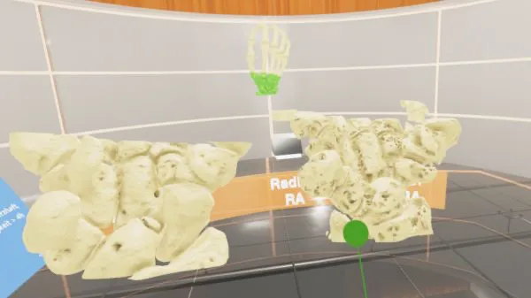 So sieht es aus, wenn man virtuell durch ein Handgelenk spaziert. (Foto: Johannes Lang)